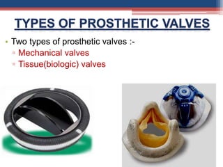 • Two types of prosthetic valves :-
▫ Mechanical valves
▫ Tissue(biologic) valves
 