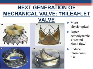 NEXT GENERATION OF
MECHANICAL VALVE: TRILEAFLET
VALVE  More
physiological
 Better
hemodynamic
s ‘central
blood flow’
 Reduced
thrombosis
risk
 