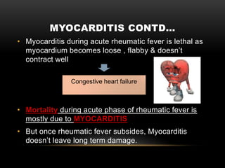Rheumatic heart disease | PPTX