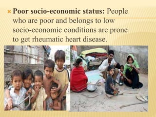 Rhd ppt BY VAISHALI | PPTX