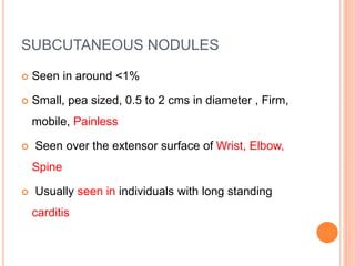 SUBCUTANEOUS NODULES
 Seen in around <1%
 Small, pea sized, 0.5 to 2 cms in diameter , Firm,
mobile, Painless
 Seen over the extensor surface of Wrist, Elbow,
Spine
 Usually seen in individuals with long standing
carditis
 