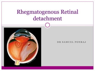 Rhegmatogenous Retinal
detachment

DR SAMUEL PONRAJ

 