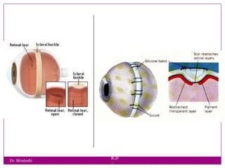 Dr. Miratashi

R.D
.

 