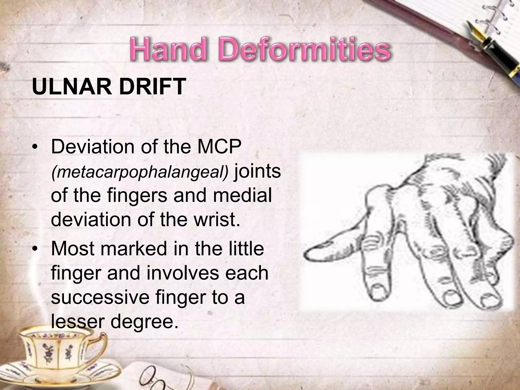 ULNAR DRIFT
• Deviation of the MCP
(metacarpophalangeal) joints
of the fingers and medial
deviation of the wrist.
• Most marked in the little
finger and involves each
successive finger to a
lesser degree.
 