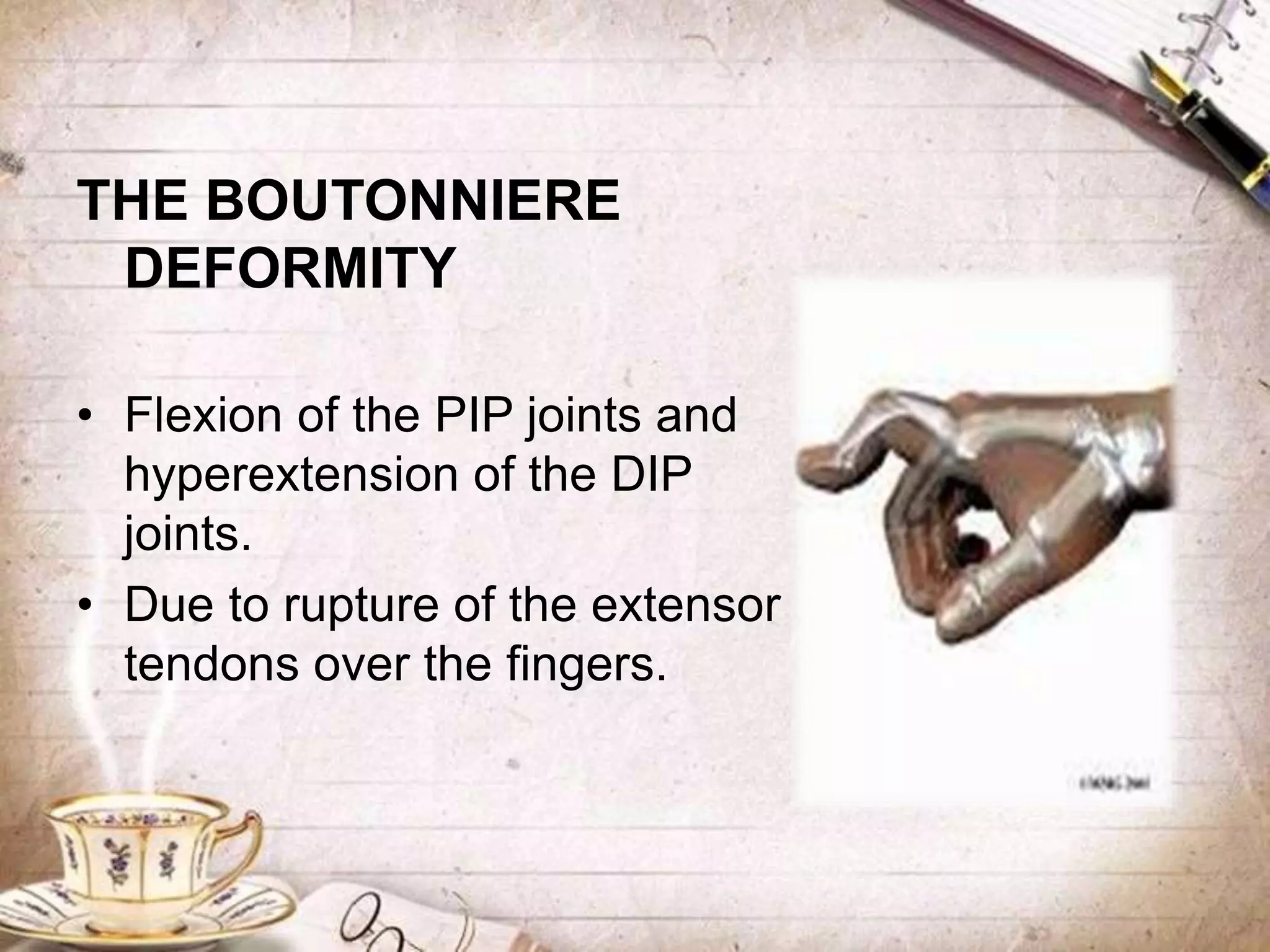 THE BOUTONNIERE
DEFORMITY
• Flexion of the PIP joints and
hyperextension of the DIP
joints.
• Due to rupture of the extensor
tendons over the fingers.
 