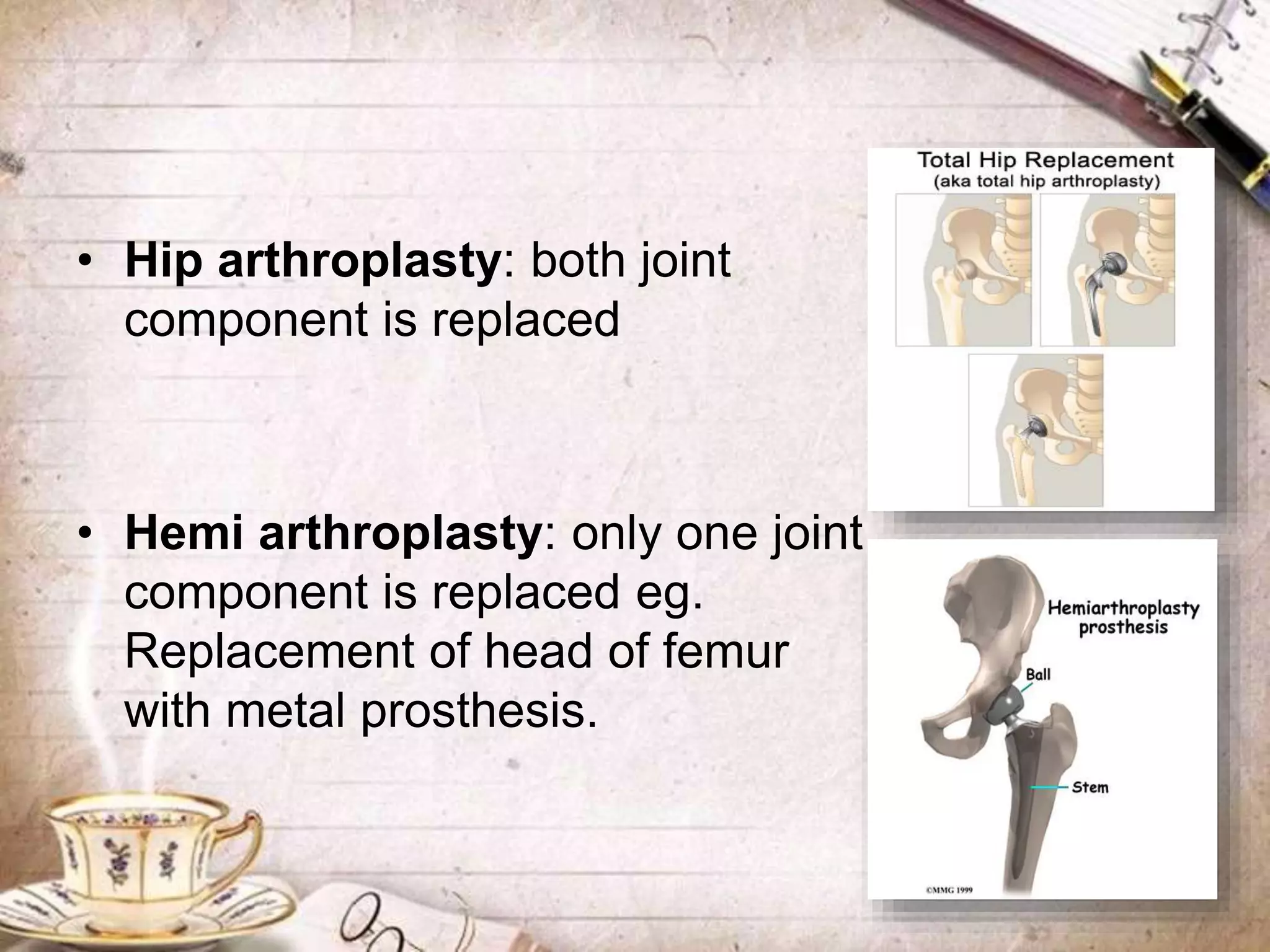 • Hip arthroplasty: both joint
component is replaced
• Hemi arthroplasty: only one joint
component is replaced eg.
Replacement of head of femur
with metal prosthesis.
 