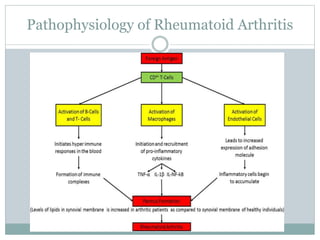 Pathophysiology of Rheumatoid Arthritis
 