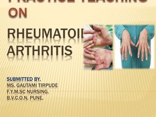 RHEUMATOID
ARTHRITIS
SUBMITTED BY,
MS. GAUTAMI TIRPUDE
F.Y.M.SC NURSING,
B.V.C.O.N, PUNE.
 
