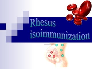 Rhesus isoimmunization 