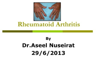 Rheumatoid Arthritis
By
Dr.Aseel Nuseirat
29/6/2013
 