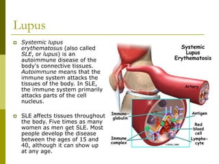 Lupus
 Systemic lupus
erythematosus (also called
SLE, or lupus) is an
autoimmune disease of the
body's connective tissues.
Autoimmune means that the
immune system attacks the
tissues of the body. In SLE,
the immune system primarily
attacks parts of the cell
nucleus.
 SLE affects tissues throughout
the body. Five times as many
women as men get SLE. Most
people develop the disease
between the ages of 15 and
40, although it can show up
at any age.
 
