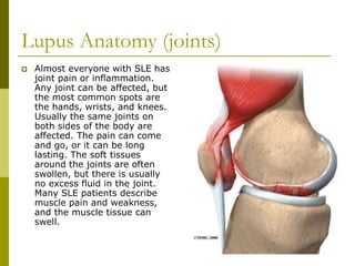 Lupus Anatomy (joints)
 Almost everyone with SLE has
joint pain or inflammation.
Any joint can be affected, but
the most common spots are
the hands, wrists, and knees.
Usually the same joints on
both sides of the body are
affected. The pain can come
and go, or it can be long
lasting. The soft tissues
around the joints are often
swollen, but there is usually
no excess fluid in the joint.
Many SLE patients describe
muscle pain and weakness,
and the muscle tissue can
swell.
 