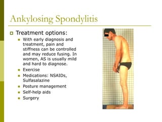 Ankylosing Spondylitis
 Treatment options:
 With early diagnosis and
treatment, pain and
stiffness can be controlled
and may reduce fusing. In
women, AS is usually mild
and hard to diagnose.
 Exercise
 Medications: NSAIDs,
Sulfasalazine
 Posture management
 Self-help aids
 Surgery
 