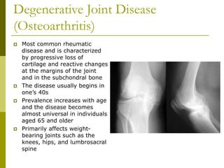 Degenerative Joint Disease
(Osteoarthritis)
 Most common rheumatic
disease and is characterized
by progressive loss of
cartilage and reactive changes
at the margins of the joint
and in the subchondral bone
 The disease usually begins in
one’s 40s
 Prevalence increases with age
and the disease becomes
almost universal in individuals
aged 65 and older
 Primarily affects weight-
bearing joints such as the
knees, hips, and lumbrosacral
spine
 