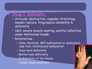  Stage 3 deformity :
  – Articular destruction, capsular stretching,
    tendon rupture. Progressive instability &
    deformity.
  – S&S: severe muscle wasting, painful callosities
    under metatarsal heads.
  – Deformities :
     o Ulnar deviation, MCP subluxation or dislocation,
       claw feet, atlantoaxial sublaxation
     o Swan neck deformity
     o Button hole deformity
     o Z deformity of the thumb
     o Carpal tunnel syndrome
 