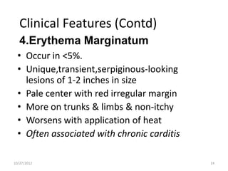 Clinical Features (Contd)
   4.Erythema Marginatum
  • Occur in <5%.
  • Unique,transient,serpiginous-looking
    lesions of 1-2 inches in size
  • Pale center with red irregular margin
  • More on trunks & limbs & non-itchy
  • Worsens with application of heat
  • Often associated with chronic carditis

10/27/2012                                   14
 