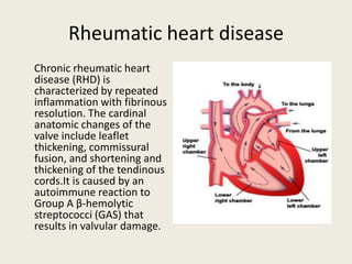 Rheumatic heart disease
Chronic rheumatic heart
disease (RHD) is
characterized by repeated
inflammation with fibrinous
resolution. The cardinal
anatomic changes of the
valve include leaflet
thickening, commissural
fusion, and shortening and
thickening of the tendinous
cords.It is caused by an
autoimmune reaction to
Group A β-hemolytic
streptococci (GAS) that
results in valvular damage.
 