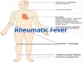 Rheumatic Fever
 