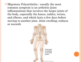  Migratory Polyarthritis : usually the most 
common symptom is an arthritis (joint 
inflammation) that involves the larger joints of 
the body, especially the knees, ankles, wrists, 
and elbows, and which lasts a few days before 
moving to another joint. Joint swelling; redness 
or warmth 
 