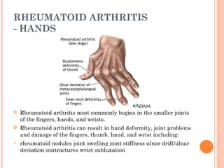 RHEUMATOID ARTHRITIS 
- HANDS 
 Rheumatoid arthritis most commonly begins in the smaller joints 
of the fingers, hands, and wrists. 
 Rheumatoid arthritis can result in hand deformity, joint problems 
and damage of the fingers, thumb, hand, and wrist including: 
 rheumatoid nodules joint swelling joint stiffness ulnar drift/ulnar 
deviation contractures wrist subluxation 
 