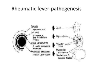 Rheumatic fever-pathogenesis
 