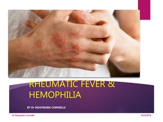 RHEUMATIC FEVER &
HEMOPHILIA
BY Dr NDAYISABA CORNEILLE
10/23/2019Dr Ndayisaba Corneille
 