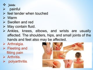  Joints:
 painful
 feel tender when touched
 Warm
 Swollen and red
 May contain fluid.
 Ankles, knees, elbows, and wrists are usually
affected. The shoulders, hips, and small joints of the
hands and feet also may be affected.
 Arthralgia.
 Fleeting and
fliting pain
 Arthritis.
 polyarthritis.
 