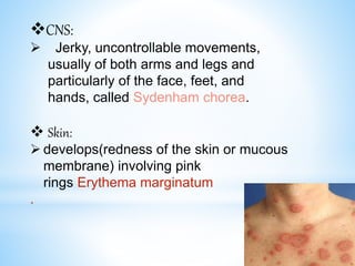CNS:
 Jerky, uncontrollable movements,
usually of both arms and legs and
particularly of the face, feet, and
hands, called Sydenham chorea.
 Skin:
 develops(redness of the skin or mucous
membrane) involving pink
rings Erythema marginatum
.
 