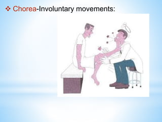  Chorea-Involuntary movements:
 