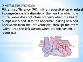 MITRAL INSUFFICIENCY:
Mitral insufficiency (MI), mitral regurgitation or mitral
incompetence is a disorderof the heart in which the
mitral valve does not close properly when the heart
pumps out blood. It is the abnormal leaking of blood
Backwards from the left ventricle, through the mitral
valve, into the left atrium,when the left ventricle
contracts
 