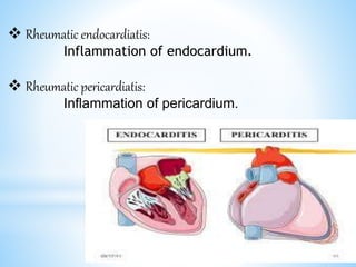  Rheumatic endocardiatis:
Inflammation of endocardium.
 Rheumatic pericardiatis:
Inflammation of pericardium.
 