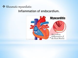  Rheumatic myoardiatis:
Inflammation of endocardium.
 