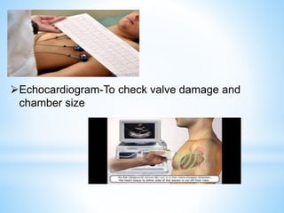 Echocardiogram-To check valve damage and
chamber size
 