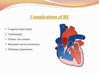 Complications of RF
 Congestive heart failure
 Cardiomegaly
 Chronic valve disease
 Rheumatic activity (recurrence)
 Pulmonary hypertension
 
