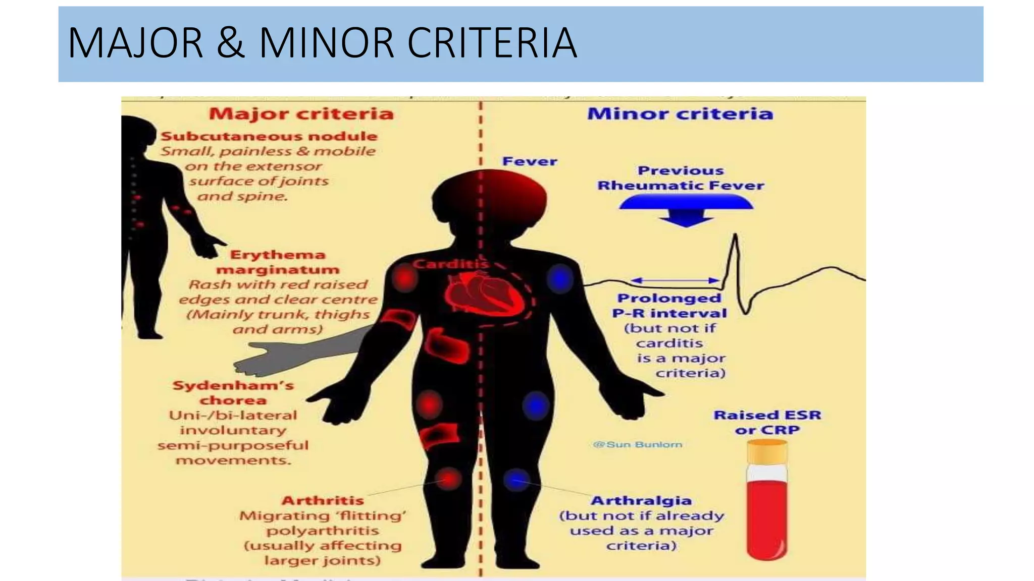 RHEUMATIC FEVER | PPTX