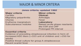 MAJOR & MINOR CRITERIA
 