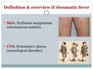 Rheumatic fever rheumatic fever....pptx