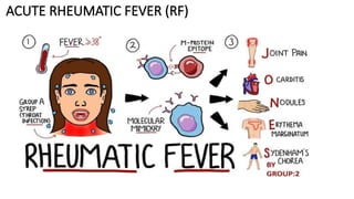 Acute RHEUMATIC FEVER management. .pptx