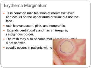RHEUMATIC FEVER and Rheumatic Heart Disease | PPTX