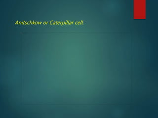Anitschkow or Caterpillar cell:
 