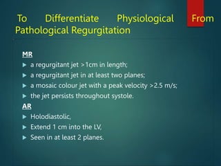 To Differentiate Physiological From
Pathological Regurgitation
MR
 a regurgitant jet >1cm in length;
 a regurgitant jet in at least two planes;
 a mosaic colour jet with a peak velocity >2.5 m/s;
 the jet persists throughout systole.
AR
 Holodiastolic,
 Extend 1 cm into the LV,
 Seen in at least 2 planes.
 