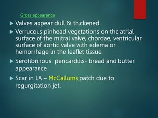 Gross appearance
 Valves appear dull & thickened
 Verrucous pinhead vegetations on the atrial
surface of the mitral valve, chordae, ventricular
surface of aortic valve with edema or
hemorrhage in the leaflet tissue
 Serofibrinous pericarditis- bread and butter
appearance
 Scar in LA – McCallums patch due to
regurgitation jet.
 