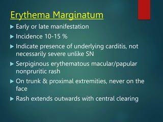 Erythema Marginatum
 Early or late manifestation
 Incidence 10-15 %
 Indicate presence of underlying carditis, not
necessarily severe unlike SN
 Serpiginous erythematous macular/papular
nonpruritic rash
 On trunk & proximal extremities, never on the
face
 Rash extends outwards with central clearing
 