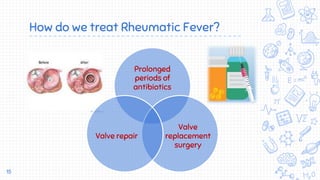 How do we treat Rheumatic Fever?
Prolonged
periods of
antibiotics
Valve
replacement
surgery
Valve repair
15
 