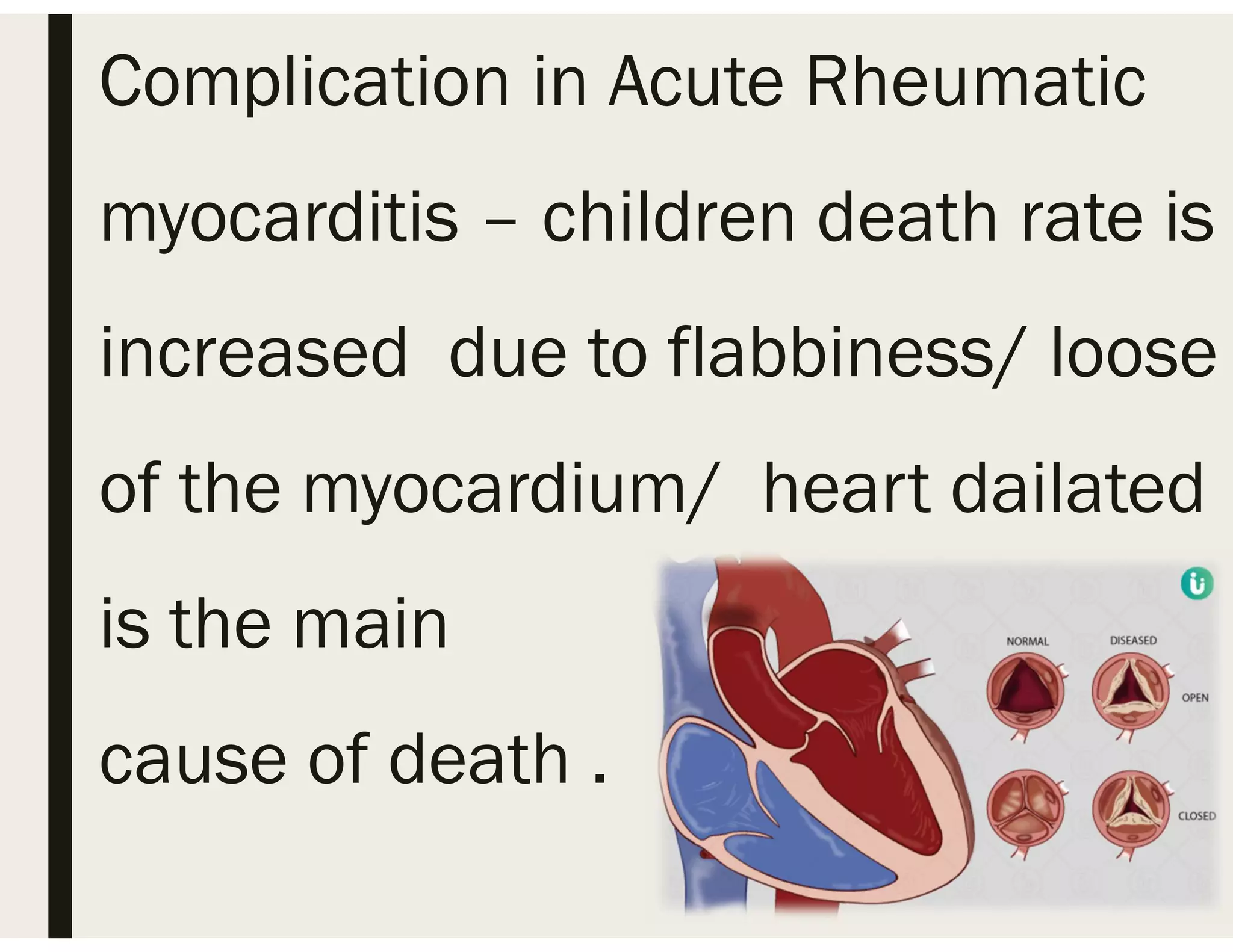 RHEUMATIC FEVER PPT .pdf