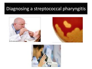 Diagnosing a streptococcal pharyngitis

 