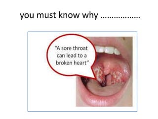 you must know why ………………

 