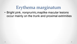 Erythema marginatum
• Bright pink, nonpruriric,maplike macular lesions
occur mainly on the trunk and proximal extrimities
 