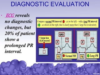 DIAGNOSTIC EVALUATION
• ECG reveals
no diagnostic
changes, but
20% of patient
show a
prolonged PR
interval.
 