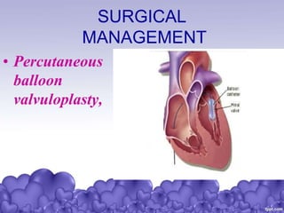 SURGICAL
MANAGEMENT
• Percutaneous
balloon
valvuloplasty,
 